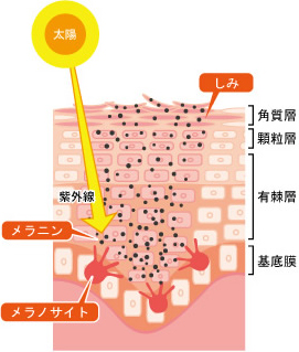 紫外線　シミ