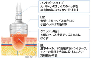 メンズシーズラボ