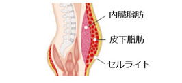 ダンディハウス